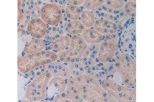 Used in DAB staining on fromalin fixed paraffin- embedded kidney tissue (RIPK2 antibody  (AA 1-294))