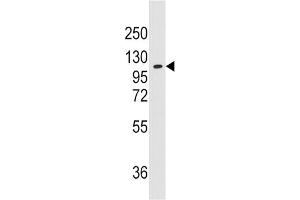 Western Blotting (WB) image for anti-Alanyl-tRNA Synthetase 2, Mitochondrial (AARS2) antibody (ABIN3003290)