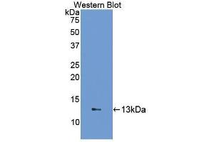 Western Blotting (WB) image for anti-Fatty Acid Binding Protein 1, Liver (FABP1) (AA 2-127) antibody (ABIN1078013) (FABP1 antibody  (AA 2-127))
