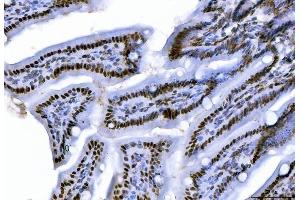 IHC analysis of CTBP2 using anti-CTBP2 antibody (ABIN7601326). (CTBP2 antibody  (AA 321-445))