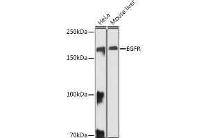 Western blot analysis of extracts of various cell lines, using EGFR antibody (ABIN6133681, ABIN6139977, ABIN6139982 and ABIN6219256) at 1:1000 dilution. (EGFR antibody  (AA 1100-1200))