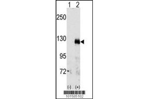 Western blot analysis of EphA3 using rabbit polyclonal EphA3 Antibody. (EPH Receptor A3 antibody  (C-Term))