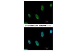 ICC/IF Image Immunofluorescence analysis of paraformaldehyde-fixed HeLa, using AF9, antibody at 1:500 dilution. (AF9 antibody  (Center))