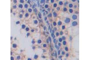 Used in DAB staining on fromalin fixed paraffin- embedded Kidney tissue (SLC2A14 antibody  (AA 1-105))