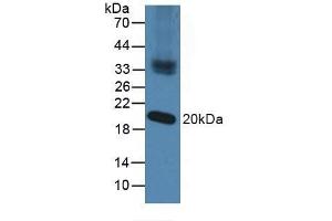 Detection of NXN in Mouse Testis Tissue using Polyclonal Antibody to Nucleoredoxin (NXN) (NXN antibody  (AA 166-327))