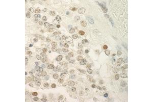 Immunohistochemistry (IHC) image for anti-Papillary Renal Cell Carcinoma (Translocation-Associated) (PRCC) (AA 125-175) antibody (ABIN7448740) (PRCC antibody  (AA 125-175))