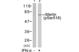 Western blot analysis of extracts from HUVEC cells untreated(lane 1) or treated with IFN-a(lane 2) using Merlin(Phospho-Ser518) Antibody. (Merlin antibody  (pSer518))