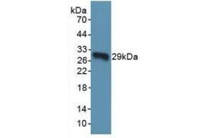 Figure. (TOR1A antibody  (AA 33-321))