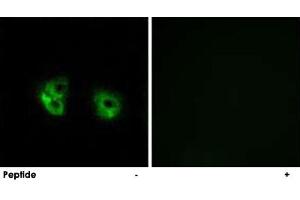 Immunofluorescence analysis of A-549 cells, using MARCH2 polyclonal antibody . (MARCH2 antibody)