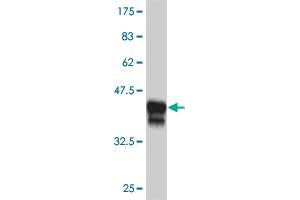 Western Blot detection against Immunogen (39. (DLX2 antibody  (AA 1-124))