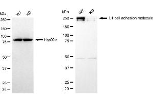Western blotting analysis using L1 cell adhesion molecule antibody (ABIN7799218).