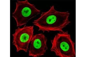 Fluorescent image of MCF-7 cells stained with Cdk4 antibody. (CDK4 antibody  (AA 272-303))