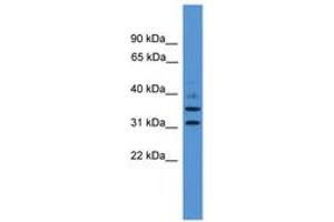 Image no. 1 for anti-GTPase, IMAP Family Member 6 (GIMAP6) (AA 151-200) antibody (ABIN6745458) (GIMAP6 antibody  (AA 151-200))