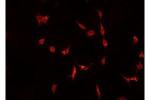 ABIN6266882 staining A-431 cells by IF/ICC. (DNAJB1 antibody  (C-Term))