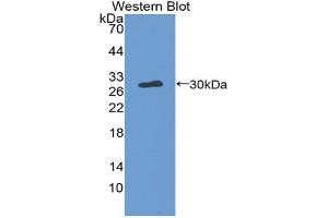 Western blot analysis of the recombinant protein. (Thrombopoietin antibody  (AA 24-266))
