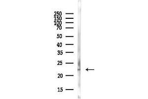Western blot analysis of lysates from Rat lung, using Rab5A Antibody at 1/1000 dilution.