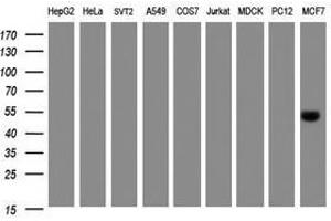 Image no. 1 for anti-Selenium Binding Protein 1 (SELENBP1) antibody (ABIN1500862) (SELENBP1 antibody)