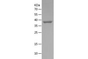 Western Blotting (WB) image for Serpin Family H Member 1 (SERPINH1) (AA 98-257) protein (His-IF2DI Tag) (ABIN7282483) (SERPINH1 Protein (AA 98-257) (His-IF2DI Tag))