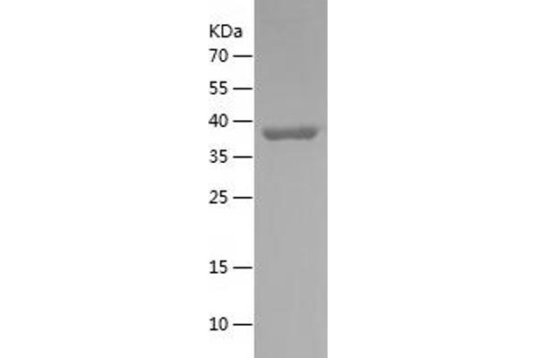 SERPINH1 Protein (AA 98-257) (His-IF2DI Tag)