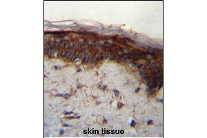 LRRC37B Antibody (C-term) (ABIN657113 and ABIN2846260) immunohistochemistry analysis in formalin fixed and paraffin embedded human skin tissue followed by peroxidase conjugation of the secondary antibody and DAB staining. (LRRC37B antibody  (C-Term))