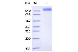 Human Her2, His Tag on SDS-PAGE under reducing (R) condition. (ErbB2/Her2 Protein (AA 23-652) (His tag))