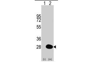 Western blot analysis of HSPB1 (arrow) using HSPB1 polyclonal antibody . (HSP27 antibody  (Ser83))