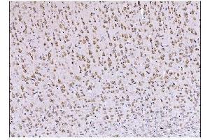 IHC analysis of DLGAP1 using anti-DLGAP1 antibody (ABIN7600257). (DLGAP1 antibody  (AA 17-319))