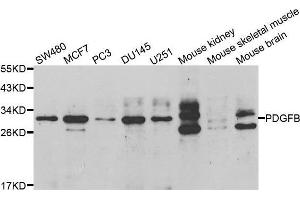 Western blot analysis of extracts of various cell lines, using PDGFB antibody. (PDGFB antibody  (AA 20-241))