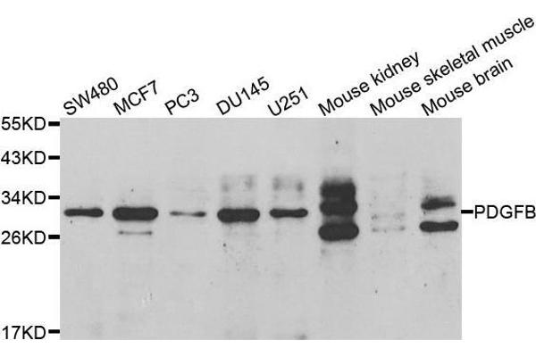 PDGFB 抗体  (AA 20-241)