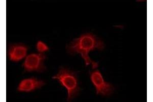 ABIN6276005 staining RAW264. (ADGRF4 (C-Term) antibody)
