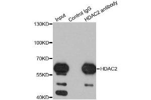 Immunoprecipitation analysis of 200ug extracts of K562 cells using 1ug HDAC2 antibody. (HDAC2 antibody  (C-Term))