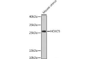 Western blot analysis of extracts of Mouse uterus using HOXC9 Polyclonal Antibody at dilution of 1:1000. (HOXC9 antibody)