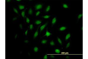 Immunofluorescence of purified MaxPab antibody to MX2 on HeLa cell. (MX2 antibody  (AA 1-715))