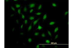 Immunofluorescence of purified MaxPab antibody to MX2 on HeLa cell.