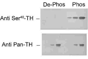 Immunohistochemical staining of retina with the pan-tyrosine hydroxylase (pan-TH) and phospho-specific tyrosine hydroxylase (phospho-TH) antibodies. (Tyrosine Hydroxylase antibody  (pSer40))