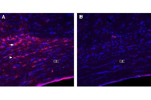 Expression of LPAR1 in rat corpus callosum (CC).