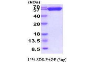 SDS-PAGE (SDS) image for CD200 (CD200) (AA 31-232) protein (hIgG-His-tag) (ABIN5854855) (CD200 Protein (CD200) (AA 31-232) (hIgG-His-tag))