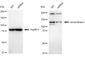 Western blotting analysis using Janus kinase 1 antibody (ABIN7799140).