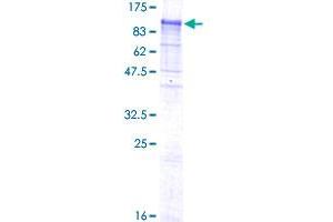 NELL1 Protein (AA 1-810) (GST tag)