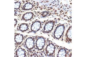 Immunohistochemistry of paraffin-embedded human colon using Histone H4 Rabbit mAb (ABIN7267706) at dilution of 1:100 (40x lens).
