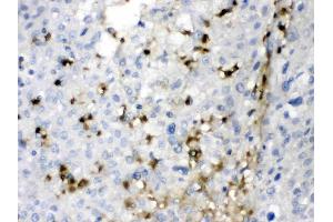 IHC analysis of CA2 using anti- CA2 antibody . (CA2 antibody  (AA 2-260))