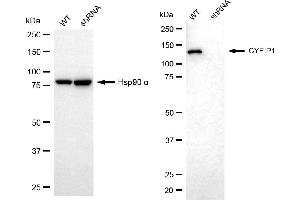 Western blotting analysis using CYFIP1 antibody (ABIN7798263).