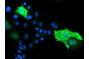 Anti-BEST3 mouse monoclonal antibody (ABIN2454025) immunofluorescent staining of COS7 cells transiently transfected by pCMV6-ENTRY BEST3 (RC218436). (Bestrophin 3 antibody)