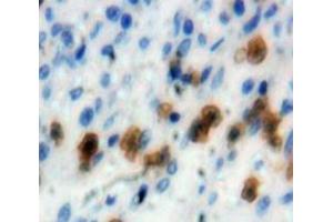 Used in DAB staining on fromalin fixed paraffin-embedded Spleen tissue (IRF4 antibody  (AA 175-433))