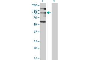Western Blot analysis of NBR1 expression in transfected 293T cell line by NBR1 monoclonal antibody (M05), clone 5C3.