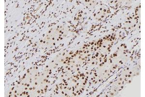 ABIN6276688 at 1/100 staining Human kidney tissue by IHC-P. (p21 antibody  (Internal Region))
