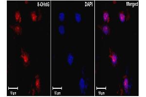 DNARNA Damage (15A3), ischemic rat brain tissue. (DNA Damage antibody)