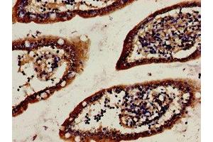 Immunohistochemistry analysis of human small intestine tissue using ABIN7142614 at dilution of 1:100 (Serotonin Receptor 1A antibody  (AA 230-334))