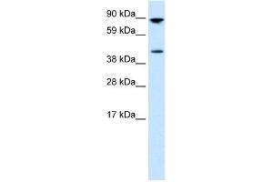 WB Suggested Anti-ETV4 Antibody Titration: 0. (ETV4 antibody  (Middle Region))