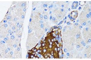 Immunohistochemistry of paraffin-embedded Mouse pancreatic islet using TIMP2 Polyclonal Antibody at dilution of 1:150 (40x lens).